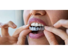 Transform Your Smile with Invisalign Treatment in Nadiad