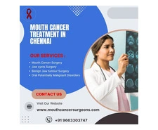 Mouth Cancer Treatment  In Chennai  - Mouthcancer Surgeons